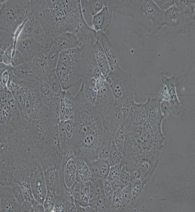 HCC1937人乳腺癌細(xì)胞主圖