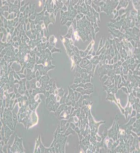 HCT-116人結腸癌細胞主圖