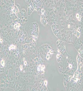 HEC-1-A人子宮內(nèi)膜腺癌細胞主圖