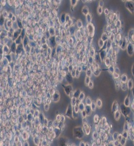 Y3-Ag 1.2.3大鼠骨髓瘤細胞主圖