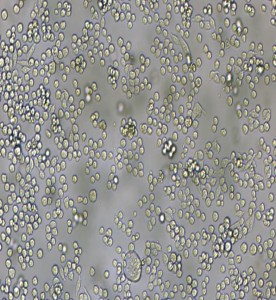 L6565小鼠白血病克隆細(xì)胞系主圖