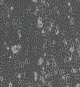 ME-180人子宮頸表皮癌細胞主圖