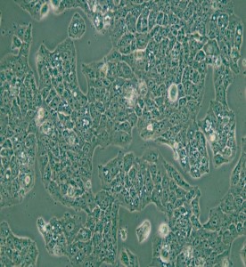 MS751人子宮頸表皮癌細(xì)胞主圖