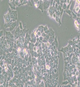 NCI-H520人肺鱗癌細胞主圖