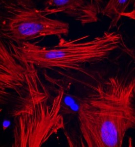 大鼠子宮平滑肌細胞主圖