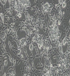 SK-N-BE(2)-C人神經(jīng)母細(xì)胞瘤細(xì)胞主圖