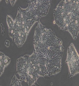 T84人結(jié)腸腺癌肺轉(zhuǎn)移細胞主圖