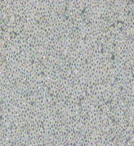 MV-4-11人髓性單核細胞白血病細胞主圖