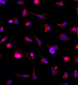 大鼠神經(jīng)小膠質(zhì)細胞主圖