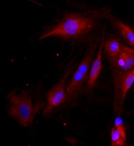 大鼠視網(wǎng)膜Muller細(xì)胞主圖