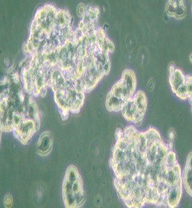 NCI-H209 [H209]人小細胞肺癌細胞主圖