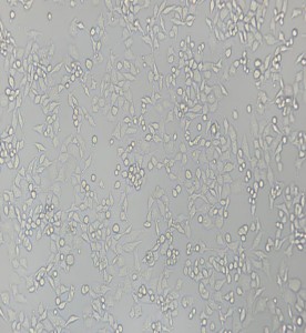 RKO-E6人結腸癌轉基因細胞主圖