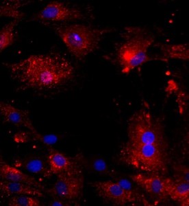 大鼠椎間盤纖維環細胞主圖