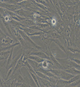 SF126人腦瘤細(xì)胞主圖