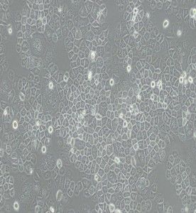 SW-13人腎上腺皮質小細胞癌細胞(L15)主圖