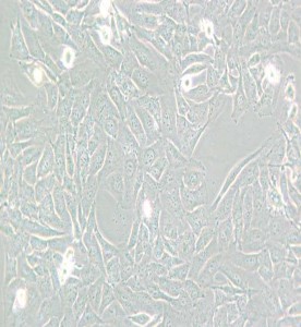 SW872人脂肪肉瘤細胞(L15) 主圖