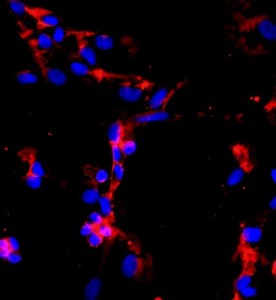 人肺微血管內皮細胞主圖