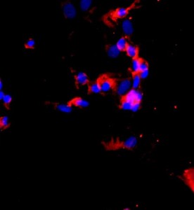 人肺大動脈內(nèi)皮細胞主圖