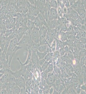 TE-10人食管癌細胞主圖