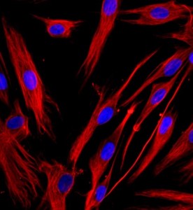 人支氣管成纖維細胞主圖