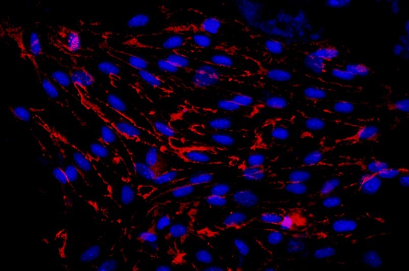 小鼠肺大動脈內皮細胞主圖