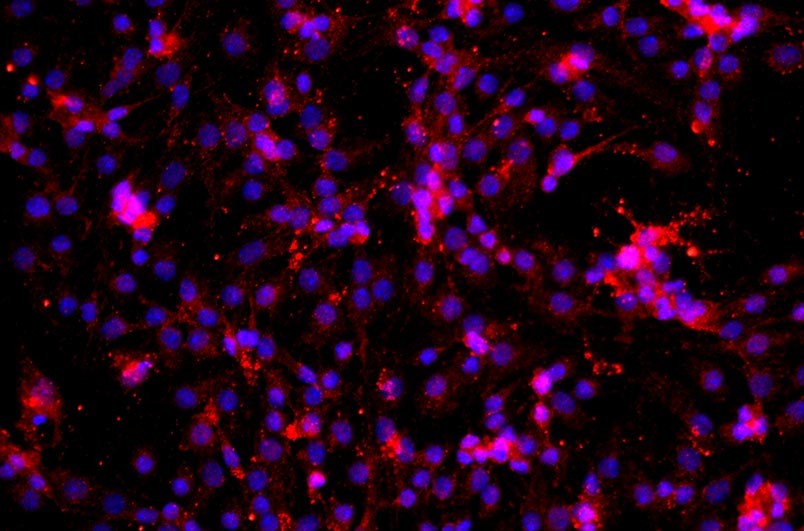 小鼠肝竇內皮細胞主圖