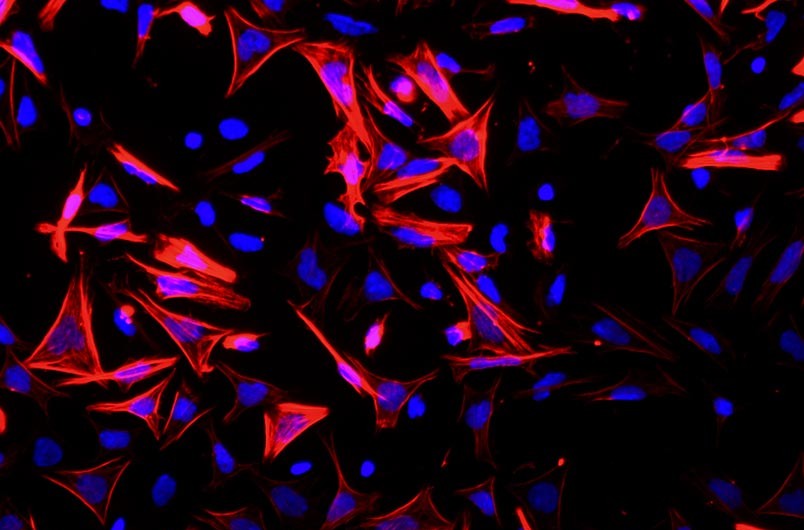 小鼠小腸平滑肌細(xì)胞主圖