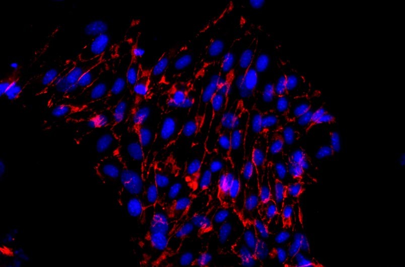 小鼠主動(dòng)脈內(nèi)皮細(xì)胞主圖