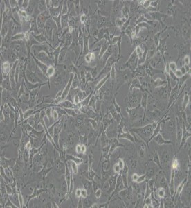 C918人眼脈絡(luò)黑色素瘤細(xì)胞主圖