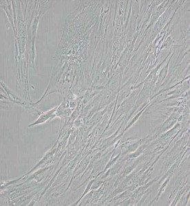 CCD-1095Sk人乳腺浸潤(rùn)性導(dǎo)管癌旁皮膚細(xì)胞主圖