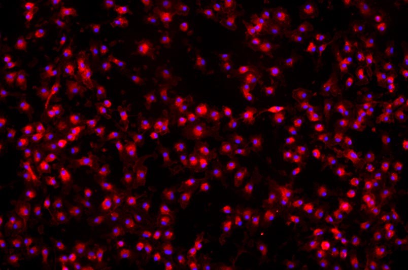 小鼠骨髓來源巨噬細胞主圖