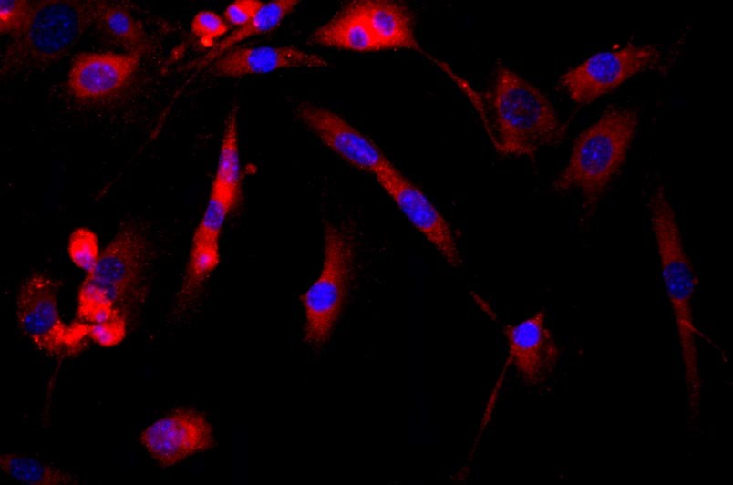 小鼠肌腱干細胞主圖