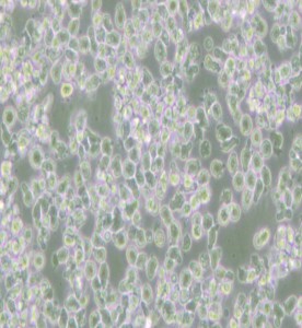 HMy2.CIR人B淋巴母細胞主圖