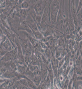 HTh-7人甲狀腺癌細胞主圖