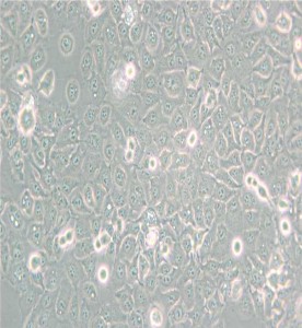 KYSE-150人食管鱗癌細胞主圖