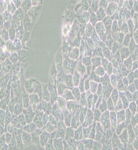 KYSE-510人食管癌細胞主圖