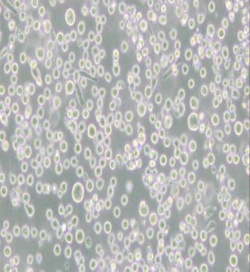 MEG-01人成巨核細(xì)胞白血病細(xì)胞主圖