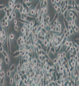 MKN-45人胃癌細(xì)胞主圖