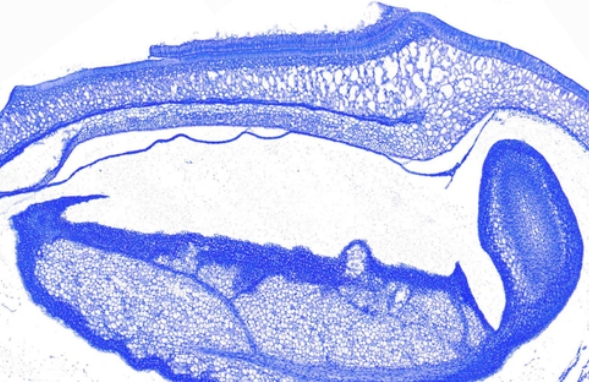 甲苯胺藍染色(肥大細胞)主圖