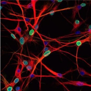 TUNEL（熒光）檢測主圖